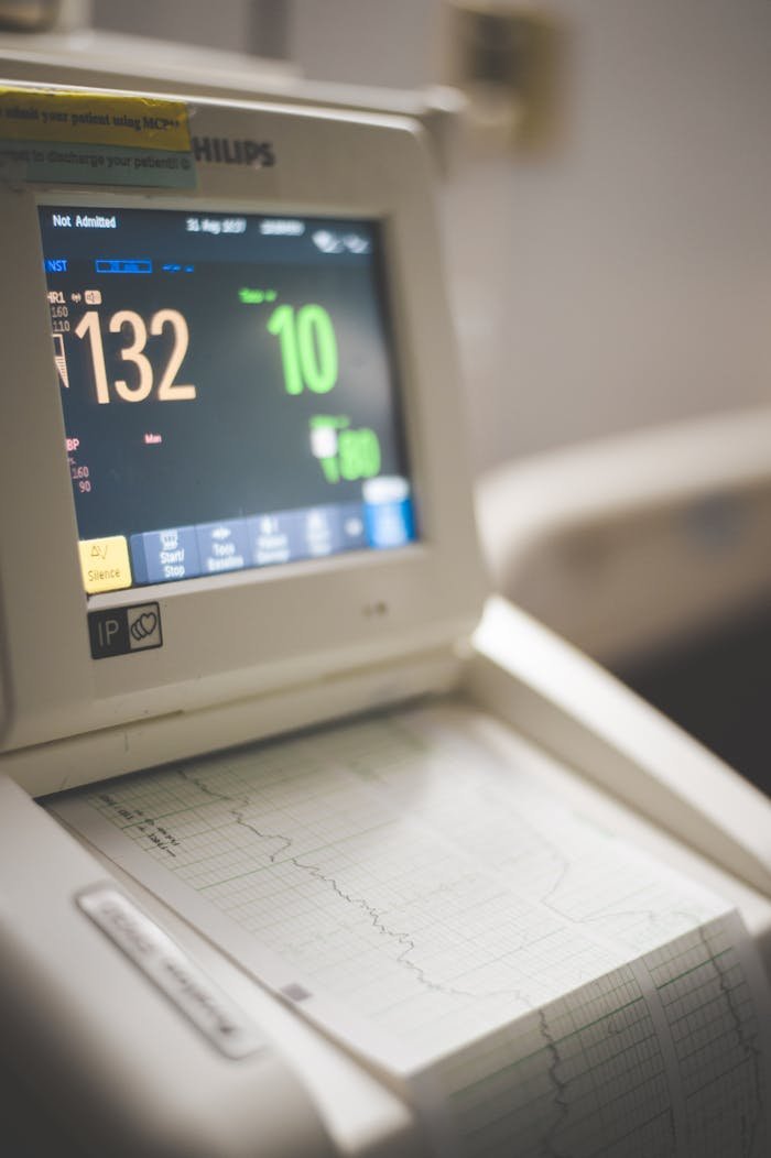 Close-up view of an ECG monitor displaying patient vitals and printed graphs.